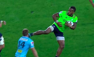 A Rugby Player Got Kicked In The Face With A Cleat And Handled It Like A Goddamn Boss