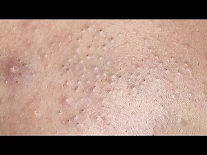 Satisfying Relaxing with Sac Dep Spa #344