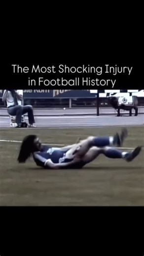 Snapped on Instagram: "14 August 1981 – One of football’s most shocking football moments. Arminia Bielefeld’s Ewald Lienen suffered a brutal tackle that ripped open his thigh exposing muscles and tissues, 23 stitches later, he was back on the pitch. Pain, resilience, and sheer courage on full display. #football #viral #explore #accident For more authentic hidden,dark ,sealed jaw dropping content follow @snappedhub"