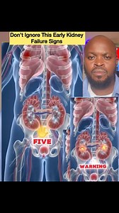 Please Do Not Overlo0k this Early Warnings from your K!dneys, before it’s too late. #fblifestyle #fyp2025シ゚ #ViralHealthTips #africandiaspora #viralnews2025 #africanculture #IbrahimTraore #kidneyhealth #kidneydisease #kidneytransplant #kidneystones | SirLawson Onyeche