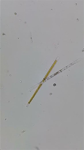 Beautiful Diatoms traveling through the microspace #science #youtube #microscope 11