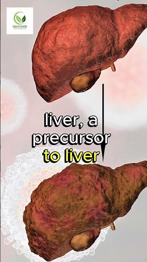 ALCOHOL vs LIVER The Shocking Truth you Need to Know!!