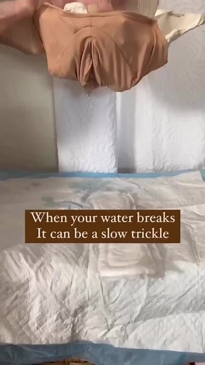 Understanding Water Breaking During Labor