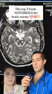 362K views · 1K reactions | BRAIN WORMS: BEWARE ⚠️缾 According to...