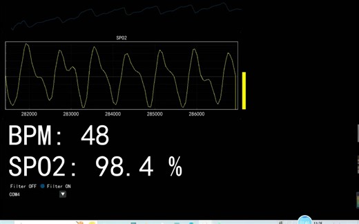 MAX30102/30100血氧心率采集系统上位机显示 Arduino-UNO python界面显示-2