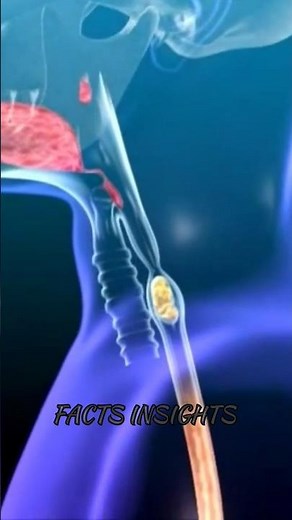 When A Child Swallowed A Live Fish