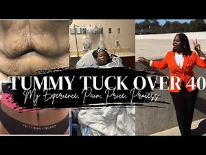 Tummy Tuck Over 40 | Recovery, Results & Real Advice 2 Years Later
