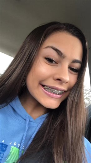 Braces Off Reveal after 5 Years