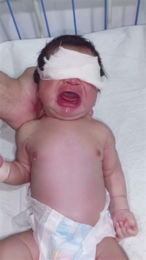 NICU Newborn with NNJ | Neonatal Jaundice Care in NICU #newbornbaby #niculife