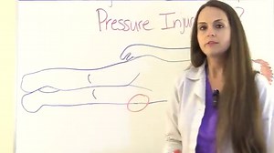 Pressure Injuries (Ulcers) NCLEX Review