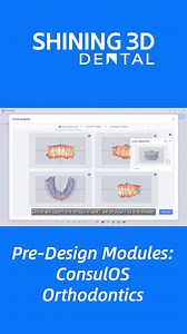 ConsulOS: Advanced Orthodontic Simulation Software 🦷 In modern orthodontics, patients want to see more than just a treatment plan — they want to visualize their results. ConsulOS delivers exactly that, combining facial data and teeth data into a powerful simulation platform that enhances both diagnostics and patient communication. ✨ Key Features of ConsulOS: ✅ Real-time orthodontic simulation – preview facial and dental changes before and after treatment setup ✅ Flexible viewing options – seaml