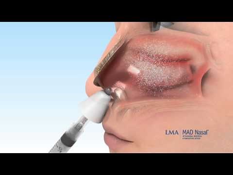 MAD Nasal™ - Français