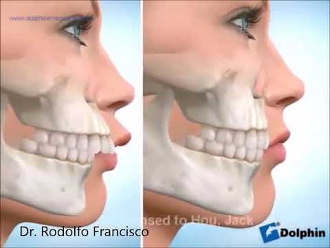 Tratamento Ortodôntico