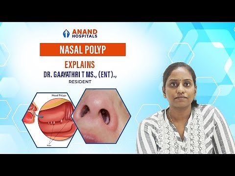 Understanding Nasal Polyps: Causes, Symptoms, and Treatment | Dr. Gaayathri
