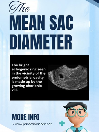 📏 Understanding Mean Sac Diameter (MSD) in Early Pregnancy! In this short video, we explore the role of the mean sac diameter (MSD) as a crucial biometric measurement during the early first trimester. 🌟 MSD helps in: - Assessing the gestational age when the embryo is not yet visible. - Evaluating the early development of pregnancy. - Detecting potential abnormalities in the gestational sac size. Learn how this measurement enhances the precision of early pregnancy assessments in fetal medicine!