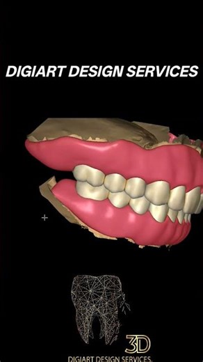 Full Denture Design #shorts #dentist #dentistry #design #exocad #sehar