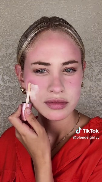 Understanding Tuberculosis: Stages, Symptoms, and Facts