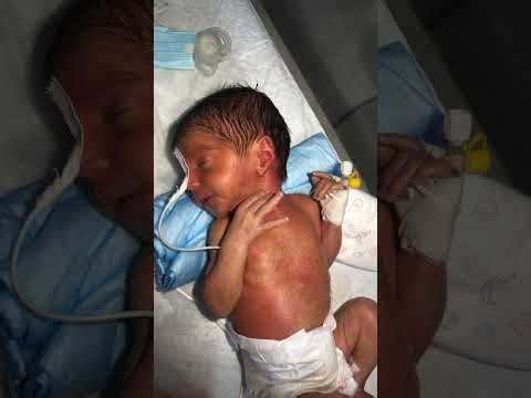 New born baby 🍼 is live!