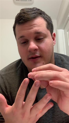 Craziest Splinter Removal Fail! 😨