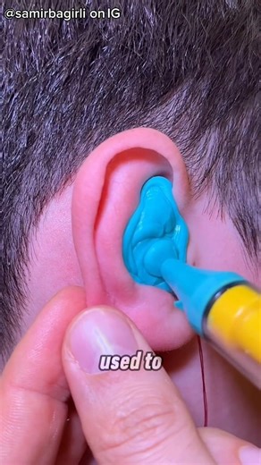 What Is He Pouring Into His Ear? 🤯