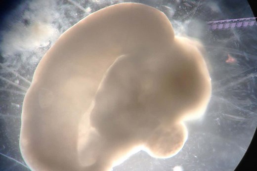 How brain organoids are revealing what truly makes humans unique