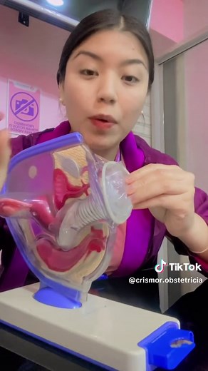 Cómo colocar el preservativo femenino paso a paso