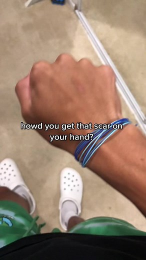 #greenscreen #fyp | eraser scar tutorial