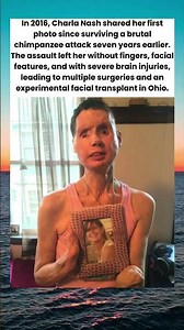 Charla Nash Shares First Photo Since Devastating Chimp Attack