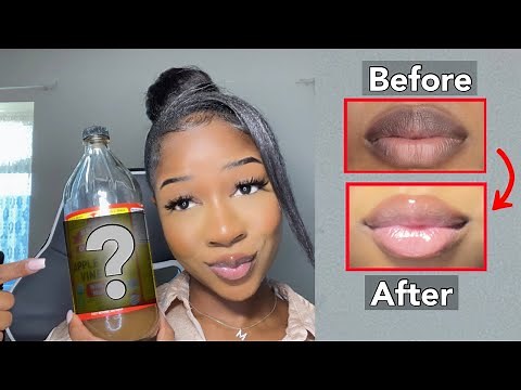 HOW I LIGHTENED MY LIPS QUICK WITH ONE PRODUCT‼️(Permanently)