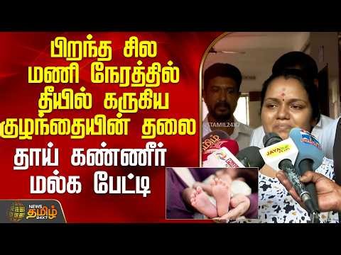 பிறந்த சில மணி நேரத்தில் தீயில் கருகிய குழந்தையின் தலை.. தாய் கண்ணீர் மல்க பேட்டி | Babyfire