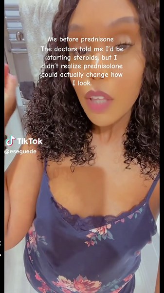 Understanding Prednisolone: Benefits and Side Effects