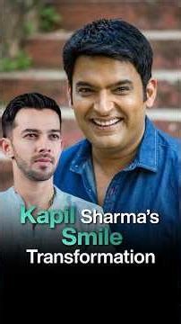 Did Kapil Sharma Get a Smile Makeover? The Real Change in His Look