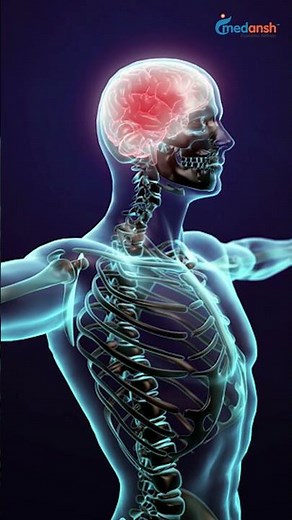 TENS vs IFT | Which Therapy Works Better for Pain Relief? #shortsviral