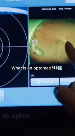 Jahnle Eye on Instagram: "An Optomap is a quick, painless retinal scan that captures a wide view of the back of your eye - no dilation needed. It helps detect early signs of conditions like glaucoma or diabetic retinopathy, giving your doctor a clear picture of your eye health in seconds. Comfortable, easy, and perfect for your routine exam. Schedule yours today at Jahnle Eye Associates: jahnleeye.com- your local Philly Eye Doctor"