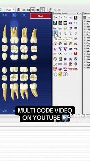 FULL step by step Dentrix treatment planning video on YouTube #dentrix #dentistry #dentalhygienist #dentalassistant #dental