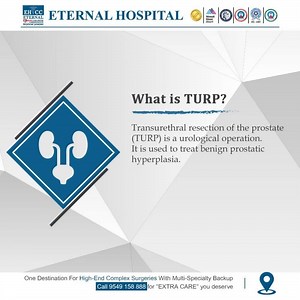 Transurethral resection of the prostate (TURP) is a urological...