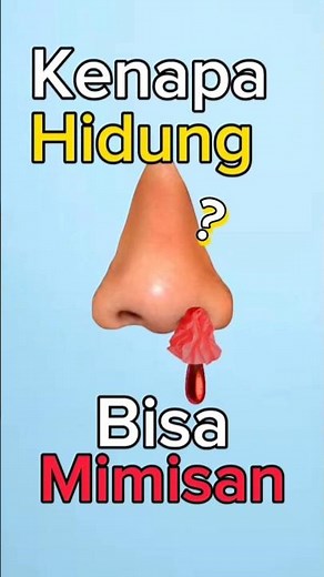 Why Do Noses Bleed?🤔👃🩸