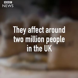 We put seven food allergy myths to the test. (Answers via the Food Standards Agency). | BBC Lifestyle & Health News