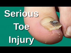 The Hidden Dangers of Leaving Old Blood Under Your Nails