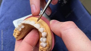 Dental technician or dentist working with tooth dentures model in his laboratory. Prosthetic dentistry technician working in his office