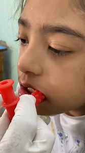 33K views · 267 reactions | Oral Motor therapy||Speech session...