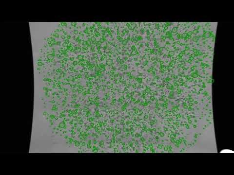 Introducing the Organoid Analysis Module | Axion Biosystems