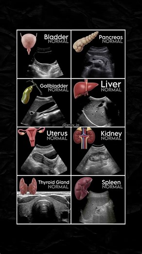 Normal appearance of human body organs ✅ #human #organ #body