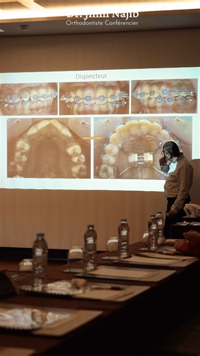 Jmili Najib on Instagram: "Vidéo Best-Off Module 4 | Formation “Maîtriser l’Orthodontie de A à Z” – Rabat ✨ L’orthodontie s’apprend, se comprend et se maîtrise — étape par étape. Un grand merci à @opheliadental pour une organisation à la hauteur de l’exigence pédagogique. — Dr Jmili Najib Orthodontiste | Conférencier"