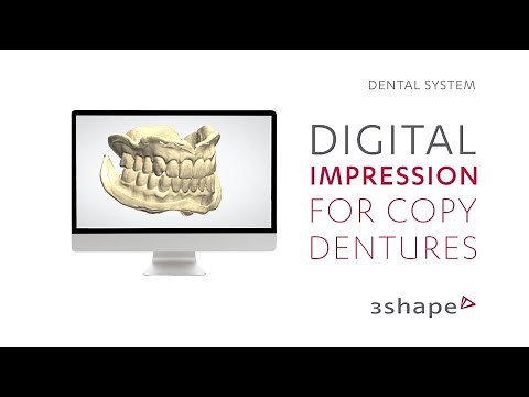 3Shape Dental System – Digital impression for copy denture
