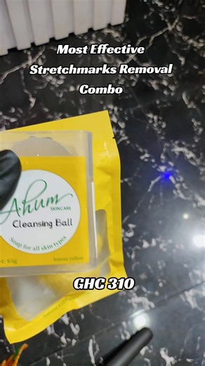 Say Goodbye to Unwanted Stretch Marks: Effective Solutions