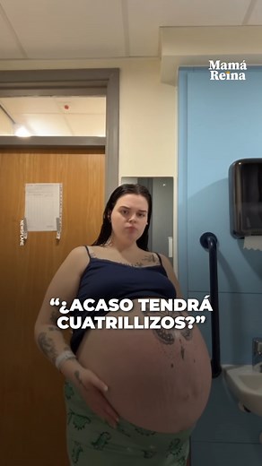 Era la panza de embarazada más grande que habían visto, estaban todos impactados, pero dentro solo había un bebé y algo más que los doctores estaban por descubrir | Upsocl