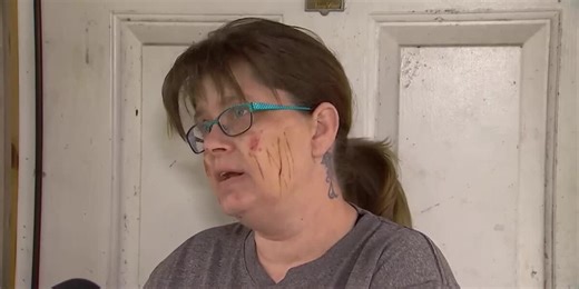 Woman says she’s lucky to be alive after coyote attack: ‘Not going to let you eat my dog’