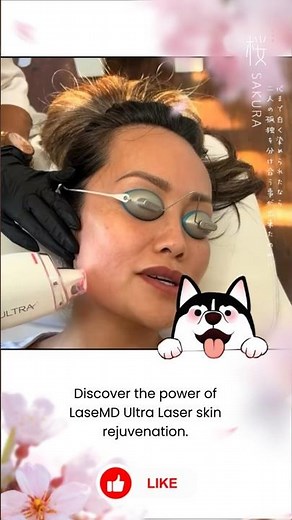 Erase Sun Damage & Melasma in Minutes with LaseMD Ultra Laser | Real Results, No Downtime!