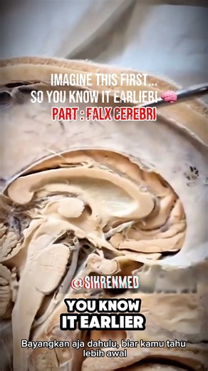 The Hidden Shield Inside Your Brain! 🧠 (Falx Cerebri Explained) #Shorts #anatomy #medicalfun